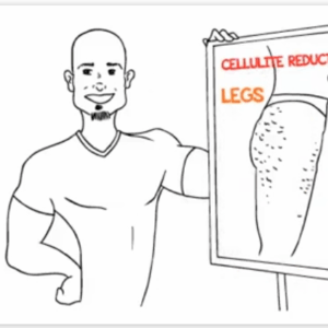Cellulite Gone- No Weight Loss No Gym Routine