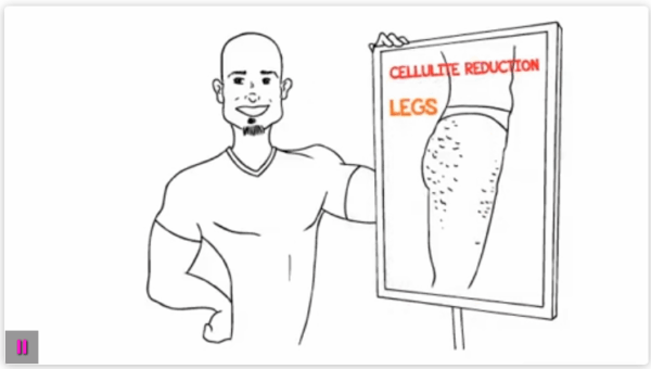 Cellulite Gone- No Weight Loss No Gym Routine